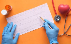 ekg1 ekg1